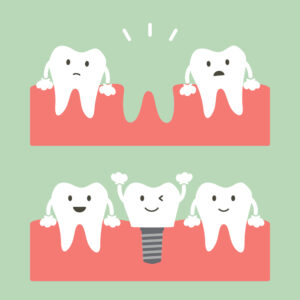 crowns vs bridges dentist-in-Craigieburn-dental-implants-in-craigieburn